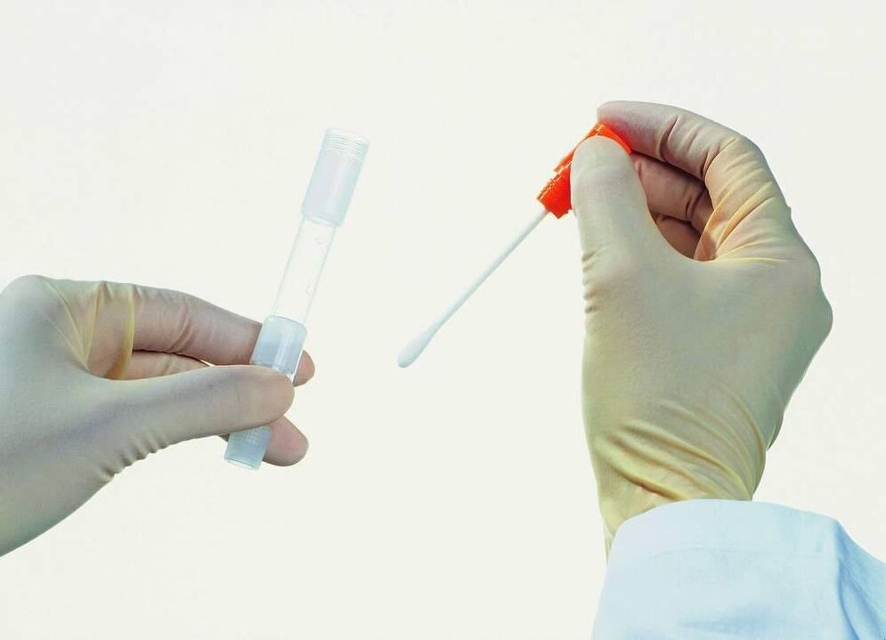 Coleção de análise para detectar prostatite crônica