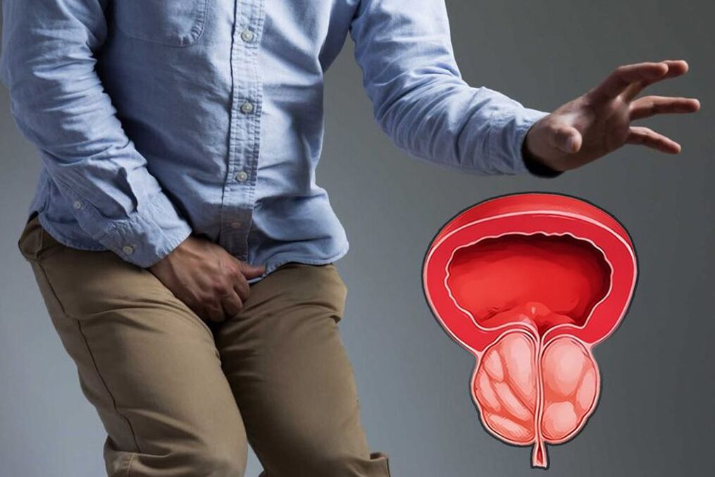 próstata aguda em homens